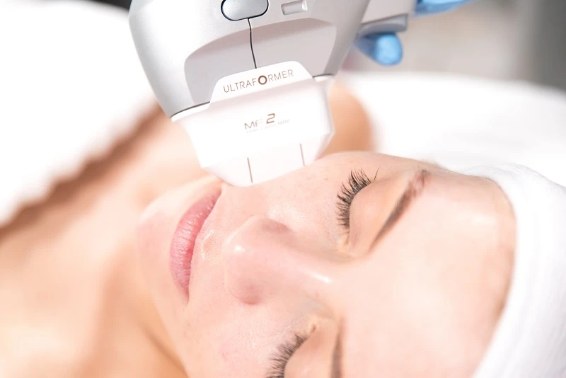 Ultraformer Ultherapy Treatment - The Clinic