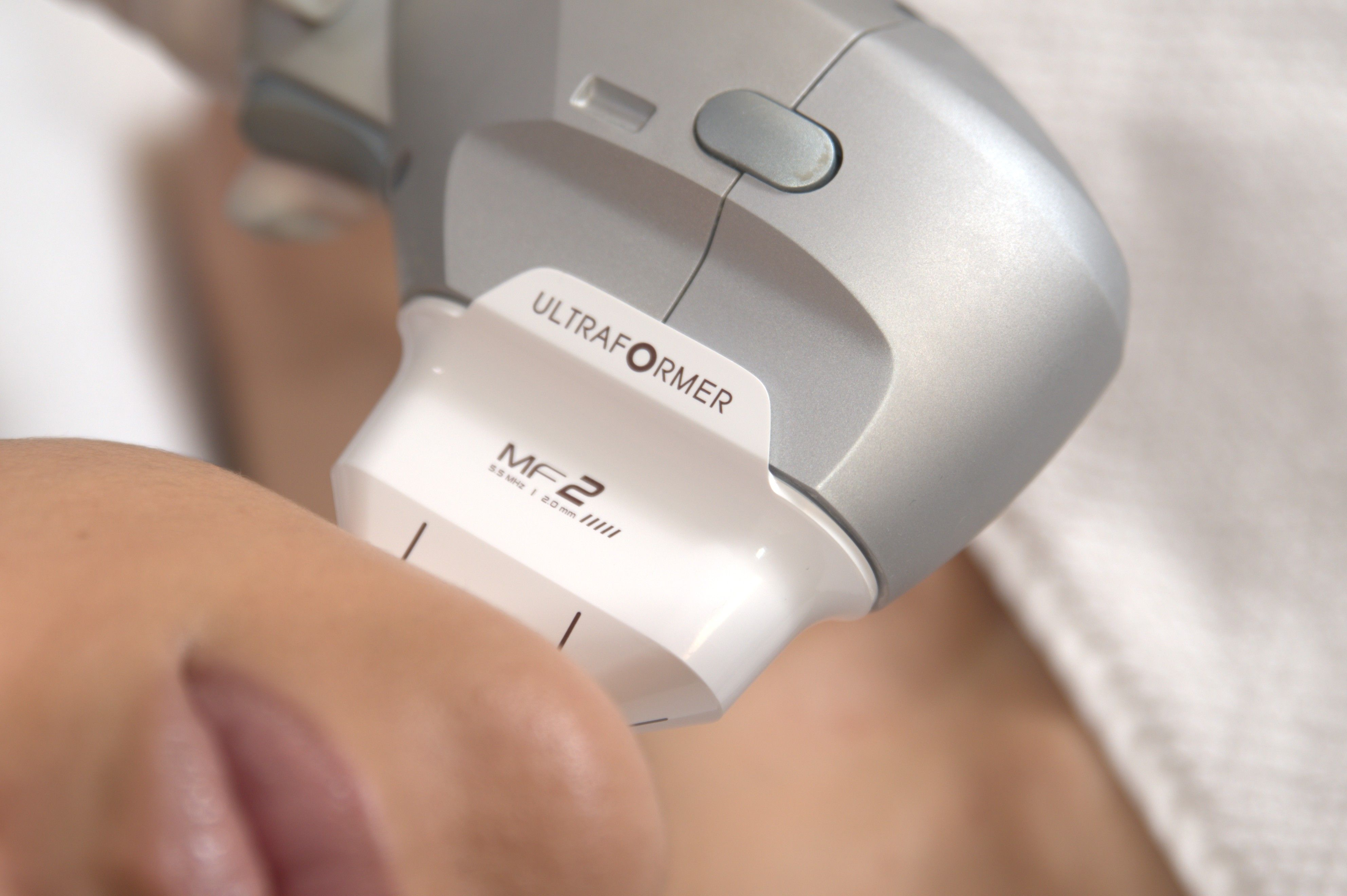 Ultraformer Treatment on the neck - The Clinic Bondi