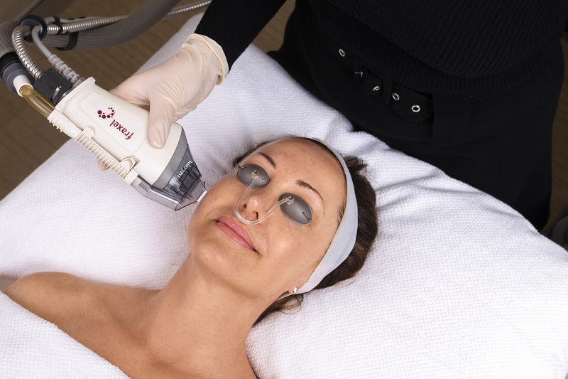 Fraxel Skin Treatment - The Clinic Bondi