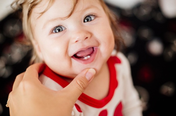 A teething baby has dribble rash, often caused by excessive drooling in babies.