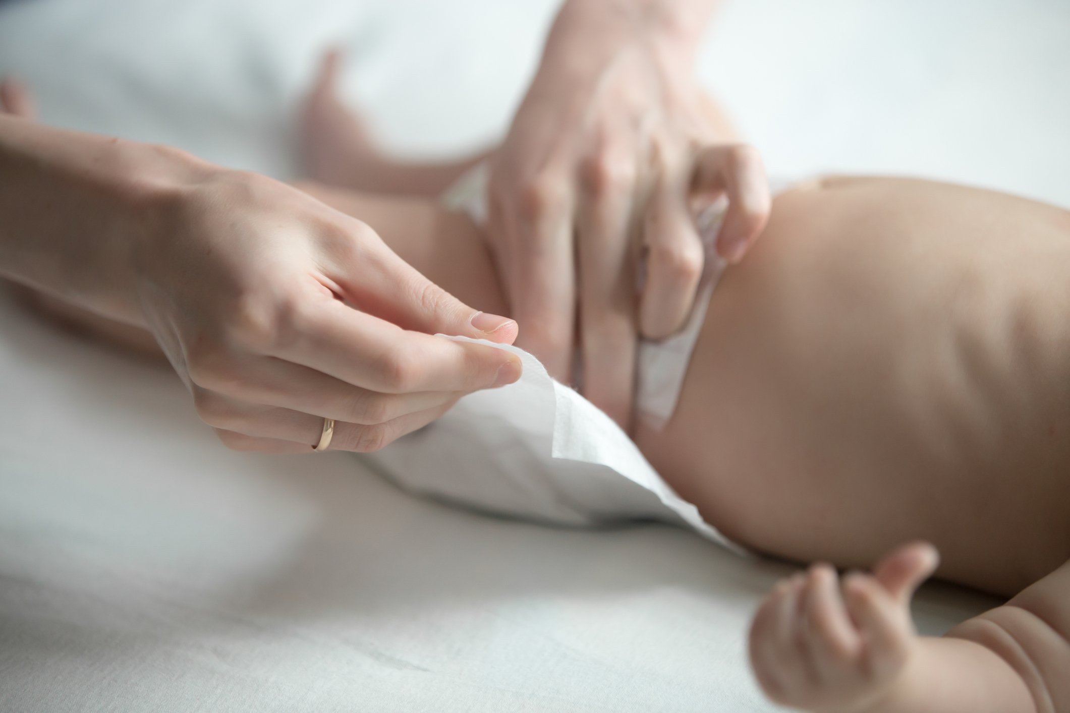 A mother changing her baby's nappy to soothe their nappy rash pains.