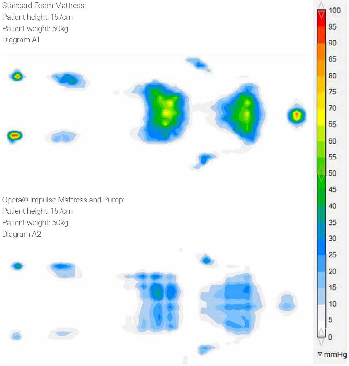 Opera Impulse Pressure Mapping