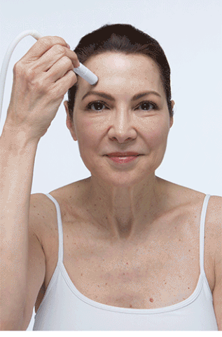 microdermabrasion at home treatment