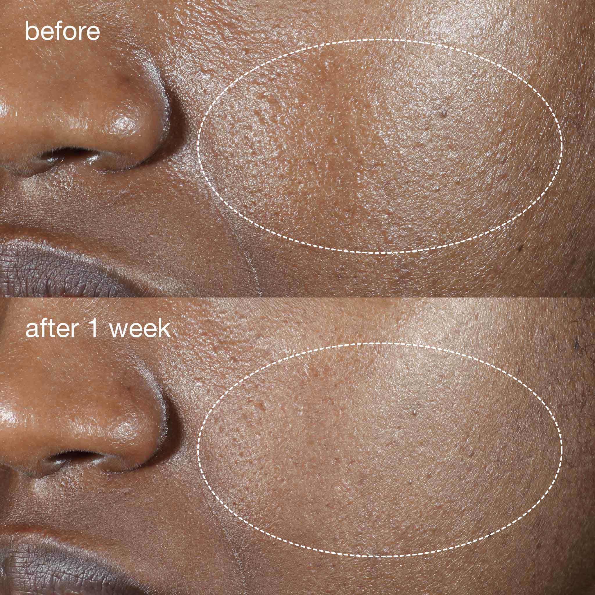 women before and after 1 week result using phyto nature oxygen cream