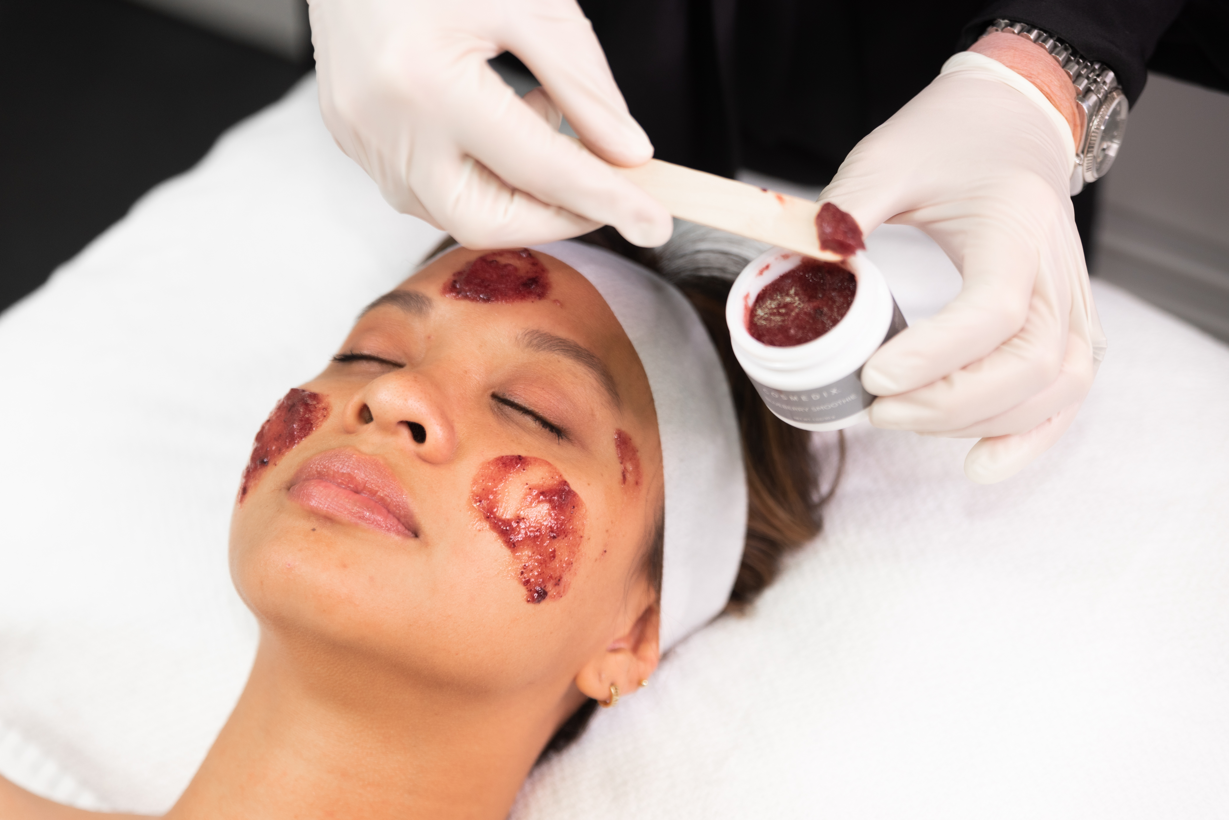 Bluberry Peel Skin Treatment Application - The Clinic Bondi