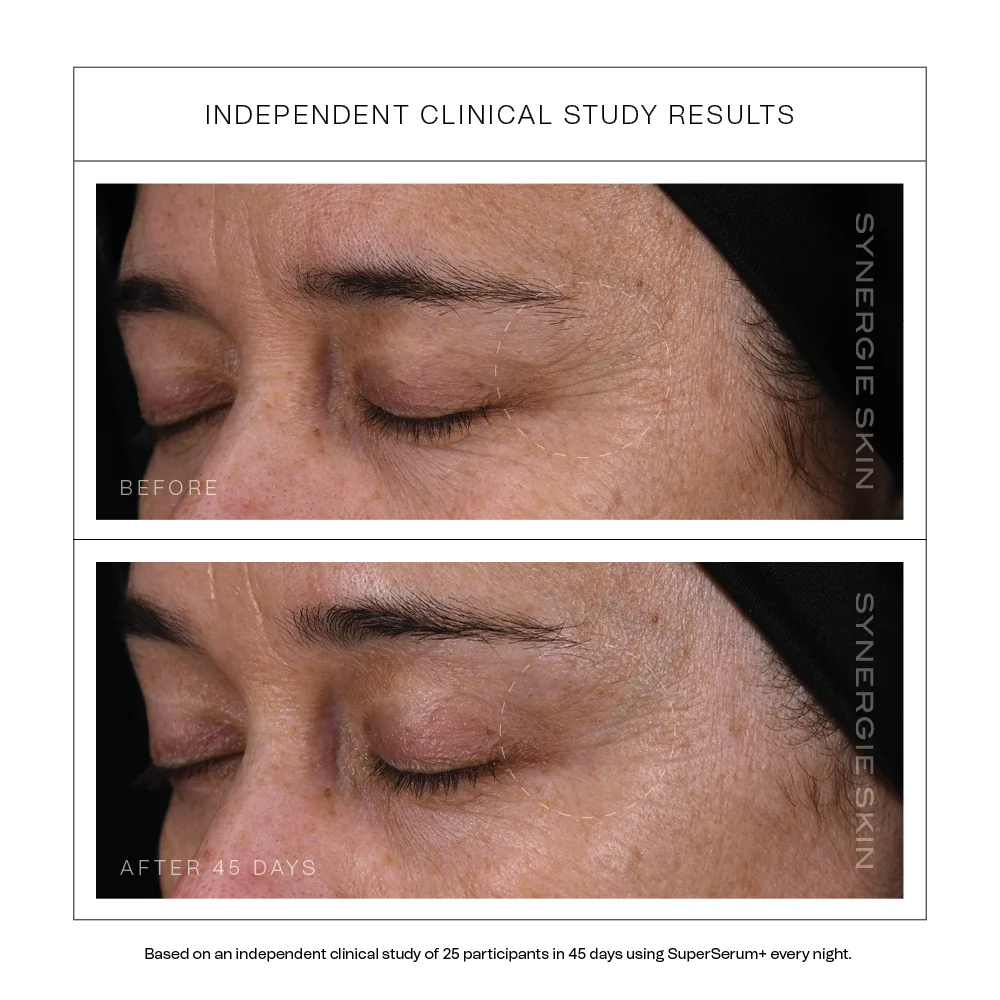 SuperSerum+ Clinical Trial results