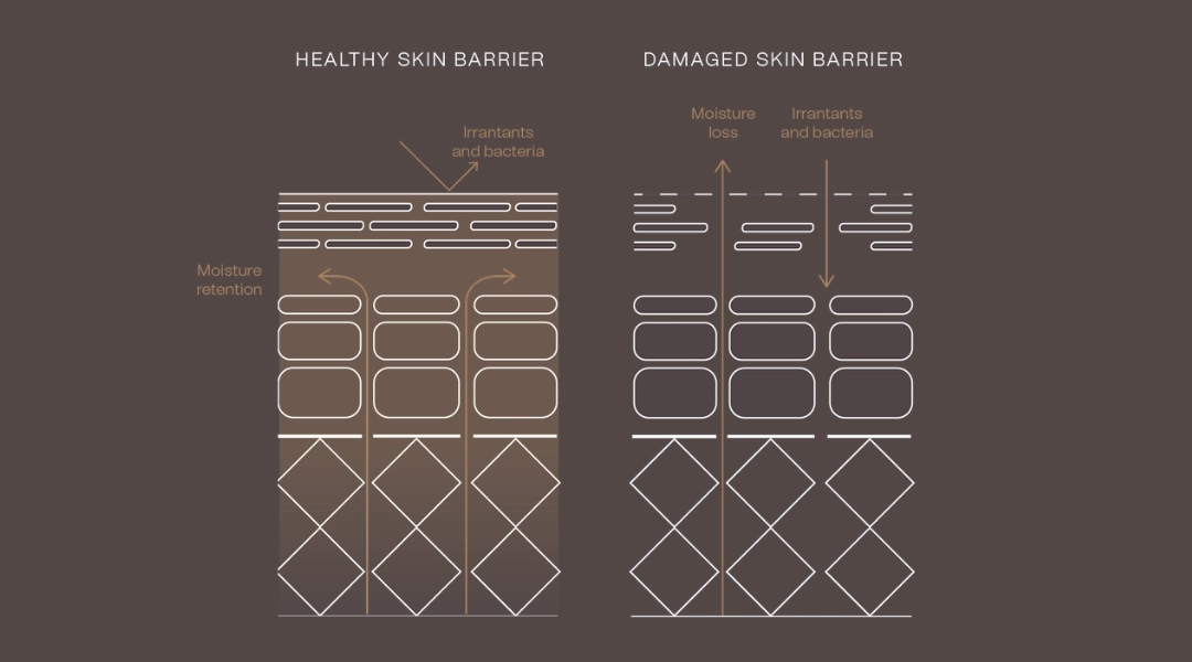 Healthy Skin Barrier Vs Damaged Skin Barrier Diagram