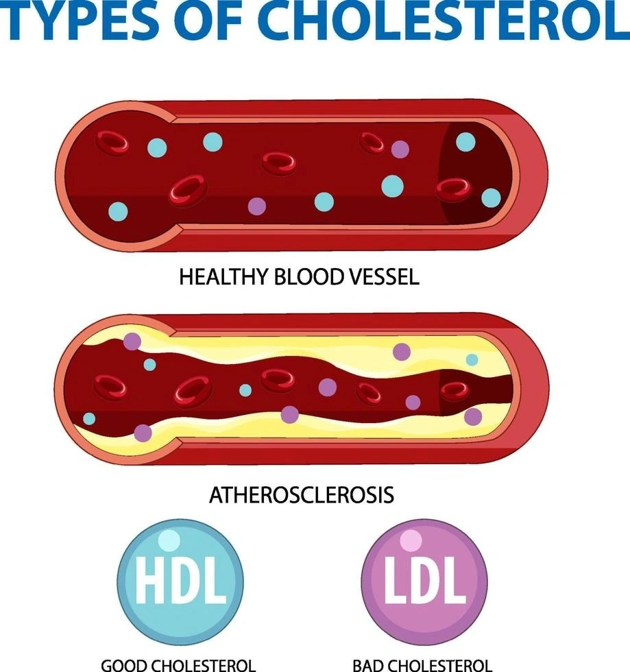 types of cholesterol